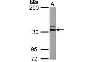 WB Image Sample (30 ug of whole cell lysate) A: IMR32 5% SDS PAGE antibody diluted at 1:1000