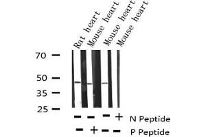 Image no. 7 for anti-GATA Binding Protein 4 (GATA4) (pSer105) antibody (ABIN6256094)