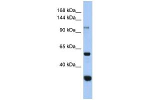 Image no. 1 for anti-Glucosidase, Alpha, Neutral C (GANC) (Middle Region) antibody (ABIN632846)