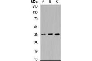 Image no. 2 for anti-Sorbitol Dehydrogenase (SORD) antibody (ABIN2967053)