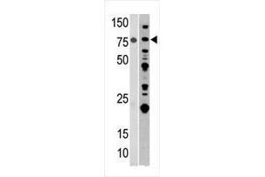 anti-Aconitase 2, Mitochondrial (ACO2) (AA 438-467) antibody