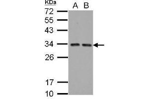Image no. 3 for anti-HIV-1 Tat Interactive Protein 2, 30kDa (HTATIP2) (full length) antibody (ABIN2857073)
