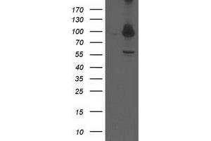 Image no. 2 for anti-Proteasome (Prosome, Macropain) 26S Subunit, Non-ATPase, 2 (PSMD2) antibody (ABIN2729985)