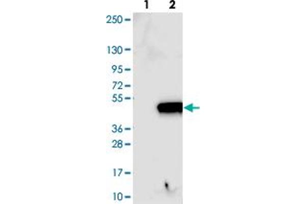 anti-Tocopherol (Alpha) Transfer Protein-Like (TTPAL) antibody