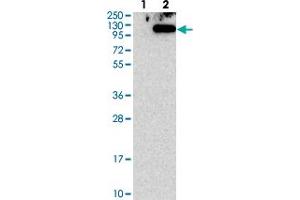 Image no. 1 for anti-TSR1, 20S rRNA Accumulation, Homolog (TSR1) antibody (ABIN5590317)