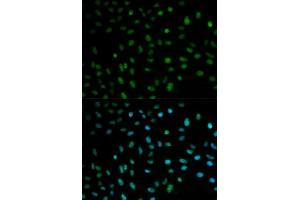 Image no. 12 for anti-ELAV (Embryonic Lethal, Abnormal Vision, Drosophila)-Like 1 (Hu Antigen R) (ELAVL1) antibody (ABIN3022231)