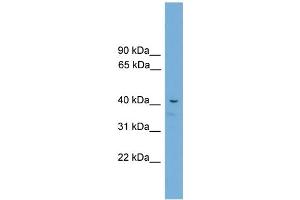 Image no. 1 for anti-Adrenocortical Dysplasia Homolog (ACD) (C-Term) antibody (ABIN2779815)