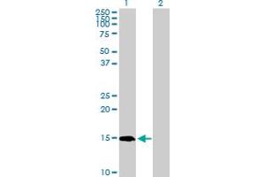 Image no. 1 for anti-Peptidyl Prolyl Cis/Trans Isomerase NIMA Interacting 4 Protein (PIN4) (AA 1-156) antibody (ABIN518907)