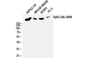 Image no. 1 for anti-Ryanodine Receptor 2 (Cardiac) (RYR2) (Ser2808) antibody (ABIN5957596)