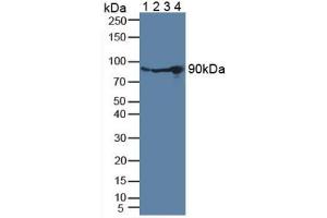 Image no. 2 for anti-Plasminogen (PLG) (AA 274-560) antibody (ABIN1078446)