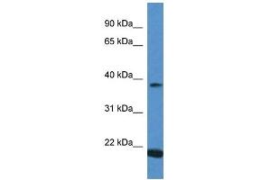 Image no. 1 for anti-Interferon, alpha 13 (IFNA13) (C-Term) antibody (ABIN926586)