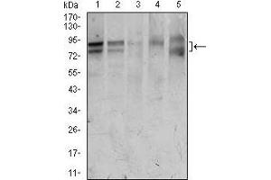 Image no. 3 for anti-Forkhead Box P1 (FOXP1) (AA 481-677) antibody (ABIN1098120)