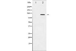 Image no. 6 for anti-Adducin 1 (Alpha) (ADD1) (pSer726) antibody (ABIN6255485)