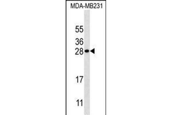 Kallikrein 7 antibody  (AA 67-97)
