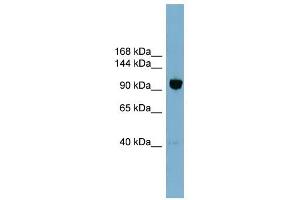 Image no. 1 for anti-Oxysterol Binding Protein-Like 8 (OSBPL8) (Middle Region) antibody (ABIN635299)