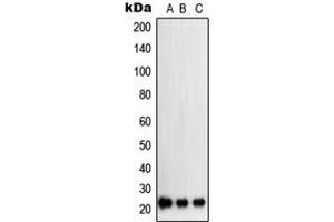 Image no. 1 for anti-Suppressor of Cytokine Signaling 2 (SOCS2) (Center) antibody (ABIN2707085)