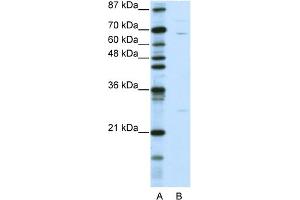 Image no. 1 for anti-Kelch-Like 13 (KLHL13) (N-Term) antibody (ABIN2775933)