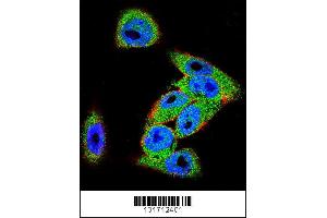 Image no. 3 for anti-Dishevelled, Dsh Homolog 3 (Drosophila) (DVL3) (AA 530-557), (C-Term) antibody (ABIN655969)