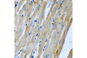 Immunohistochemical analysis of Fis1 staining in rat heart formalin fixed paraffin embedded tissue section.