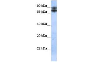 Image no. 2 for anti-LIM Domain and Actin Binding 1 (LIMA1) (N-Term) antibody (ABIN2776038)