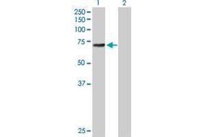 Image no. 1 for anti-Arachidonate 12-Lipoxygenase (ALOX12) (AA 1-663) antibody (ABIN513263)