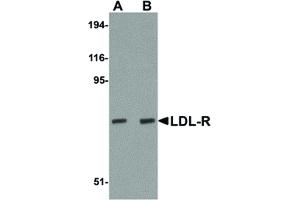 Image no. 1 for anti-Low Density Lipoprotein Receptor (LDLR) (Internal Region) antibody (ABIN6656143)