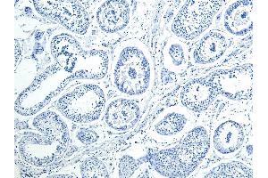 Image no. 1 for anti-Homeobox A10 (HOXA10) (Internal Region) antibody (ABIN1590026)