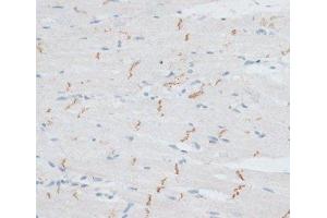Immunohistochemistry of paraffin-embedded Rat heart using N-Cadherin Polyclonal Antibody at dilution of 1:100 (40x lens).