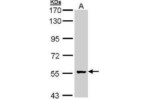 GCM2 Antikörper  (Center)