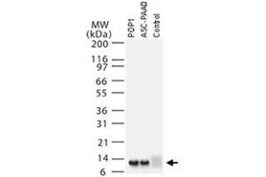 Image no. 1 for anti-PYD (Pyrin Domain) Containing 1 (PYDC1) antibody (ABIN537478)