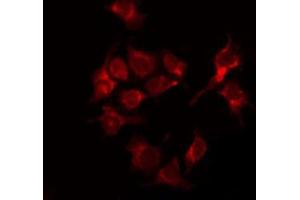Image no. 1 for anti-Tuberous Sclerosis 2 (TSC2) (pThr1462) antibody (ABIN6255593)