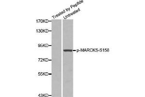 Image no. 1 for anti-Myristoylated Alanine-Rich Protein Kinase C Substrate (MARCKS) (pSer158) antibody (ABIN3020355)