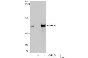 Image no. 6 for anti-rho-Associated, Coiled-Coil Containing Protein Kinase 2 (ROCK2) (Center) antibody (ABIN2855440)