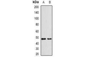 Image no. 3 for anti-Vacuolar Protein Sorting 37 Homolog A (VPS37A) antibody (ABIN2967145)