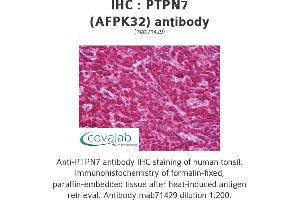 Image no. 2 for anti-Protein tyrosine Phosphatase, Non-Receptor Type 7 (PTPN7) antibody (ABIN1724484)