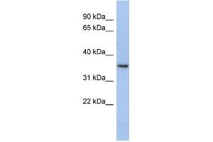 Image no. 2 for anti-Peroxisomal Biogenesis Factor 7 (PEX7) (N-Term) antibody (ABIN2786508)