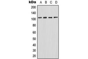 Image no. 1 for anti-Homeodomain Interacting Protein Kinase 2 (HIPK2) (C-Term) antibody (ABIN2704886)