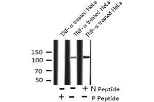 Image no. 1 for anti-PTK2 Protein tyrosine Kinase 2 (PTK2) (pTyr577) antibody (ABIN6271394)