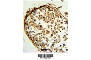 Immunohistochemistry (IHC) image for anti-Cathepsin S (CTSS) antibody (ABIN2158406)