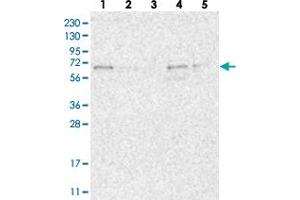 Image no. 1 for anti-Family with Sequence Similarity 63, Member A (FAM63A) antibody (ABIN5577858)