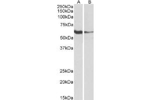 Image no. 1 for anti-Fc Receptor-Like 2 (FCRL2) (AA 92-104) antibody (ABIN5924276)