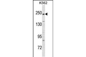 Image no. 1 for anti-Kinase D-Interacting Substrate, 220kDa (KIDINS220) (AA 1518-1547), (C-Term) antibody (ABIN5535957)