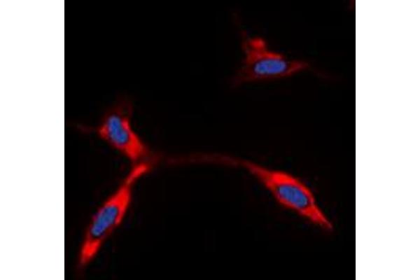 KCNJ11 antibody  (Center)