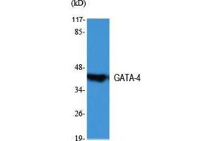 Image no. 2 for anti-GATA Binding Protein 4 (GATA4) (Internal Region) antibody (ABIN3184753)
