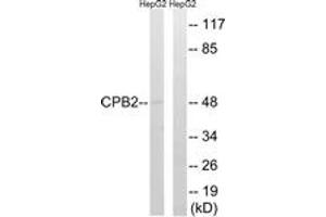 Image no. 1 for anti-Carboxypeptidase B2 (Plasma) (CPB2) (AA 321-370) antibody (ABIN1534733)