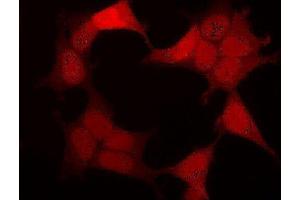 Immunofluorescence (IF) image for anti-Green Fluorescent Protein (GFP) antibody (ABIN2451988)