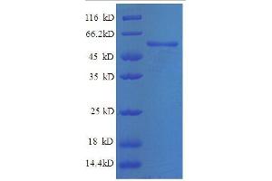 SDS-PAGE (SDS) image for Endonuclease, VIRD2 (VIRD2) (AA 1-447), (full length) protein (His tag) (ABIN1047715)