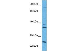 Image no. 4 for anti-Carnitine Palmitoyltransferase 1A (Liver) (CPT1A) (Middle Region) antibody (ABIN2782010)