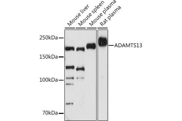 ADAMTS13 Antikörper