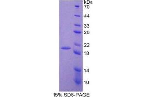 SDS-PAGE (SDS) image for Adrenomedullin (ADM) ELISA Kit (ABIN6574074)